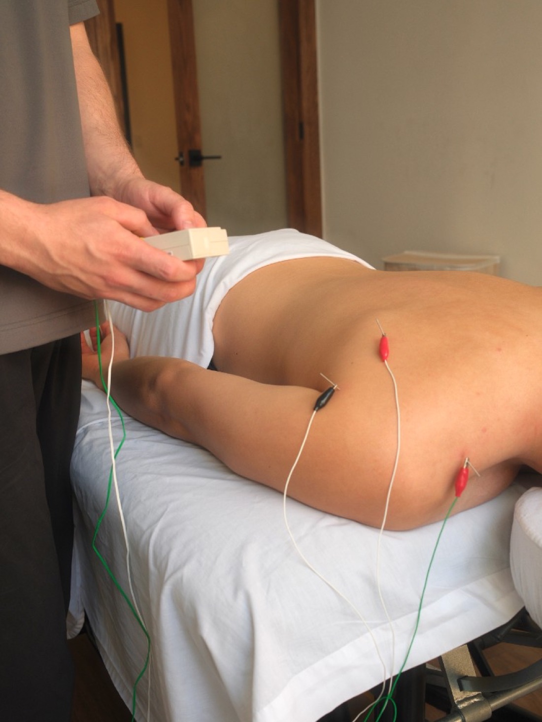 Neurofunctional Acupuncture